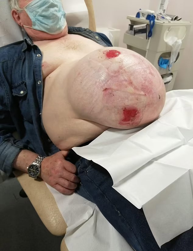 Nesretni farmer sada jedva može hodati (FOTO: dailymail.co.uk)