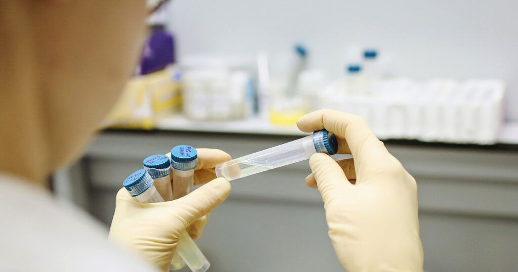 covid 19 koronavirus