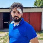 mirza dervisevic