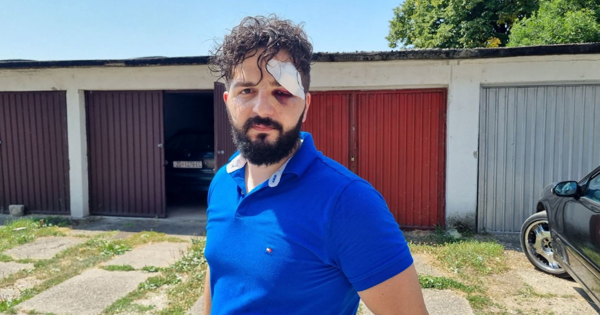 mirza dervisevic
