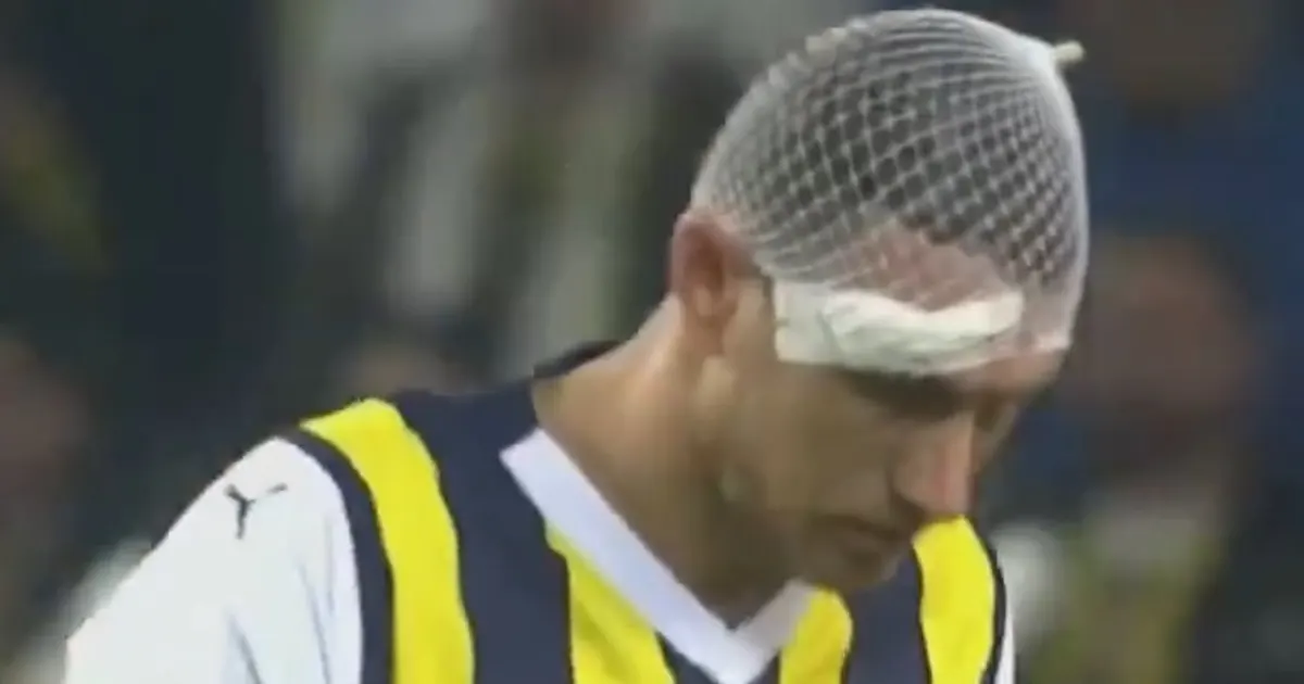 edin dzeko