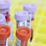 krv testiranje laboratorija nalazi