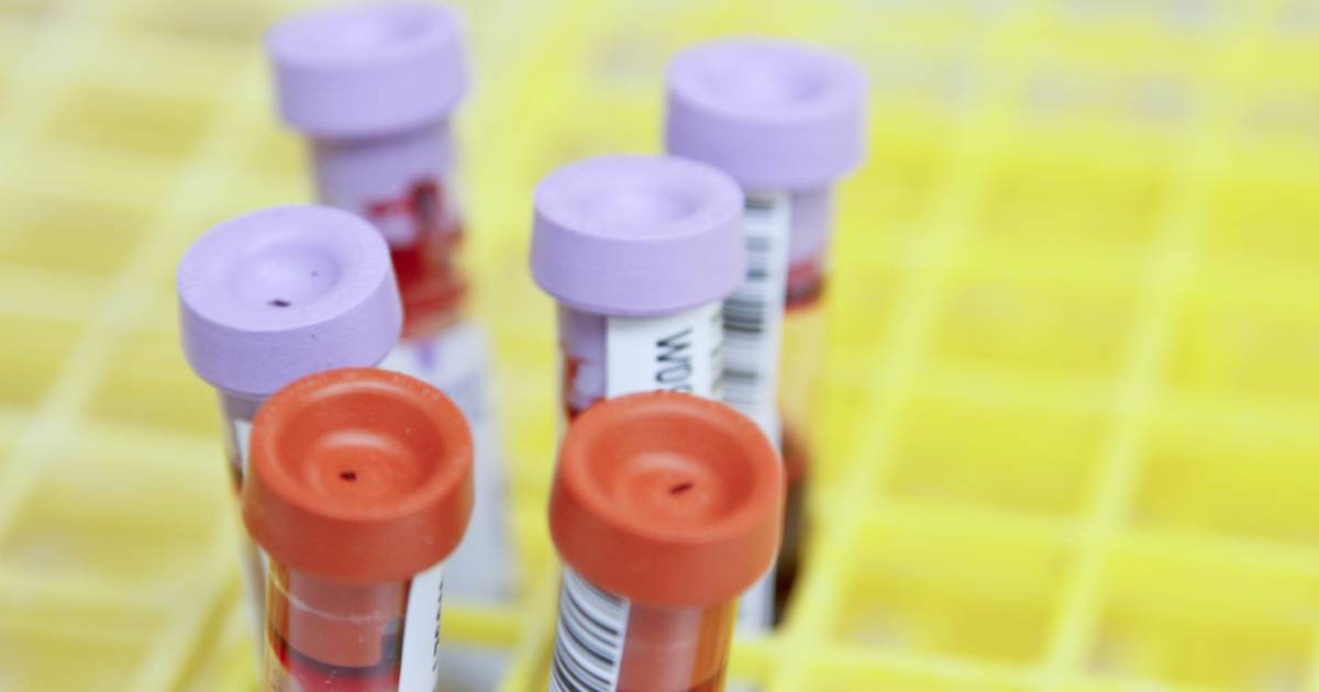 krv testiranje laboratorija nalazi