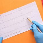 srcani udar ekg