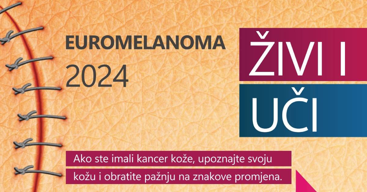 melanom pregledi