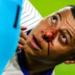 mbappe nos