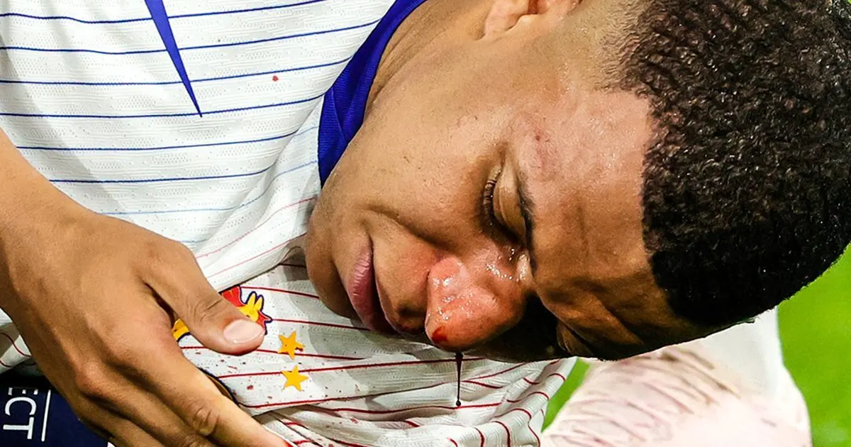 mbappe