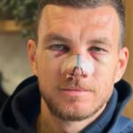 edin dzeko