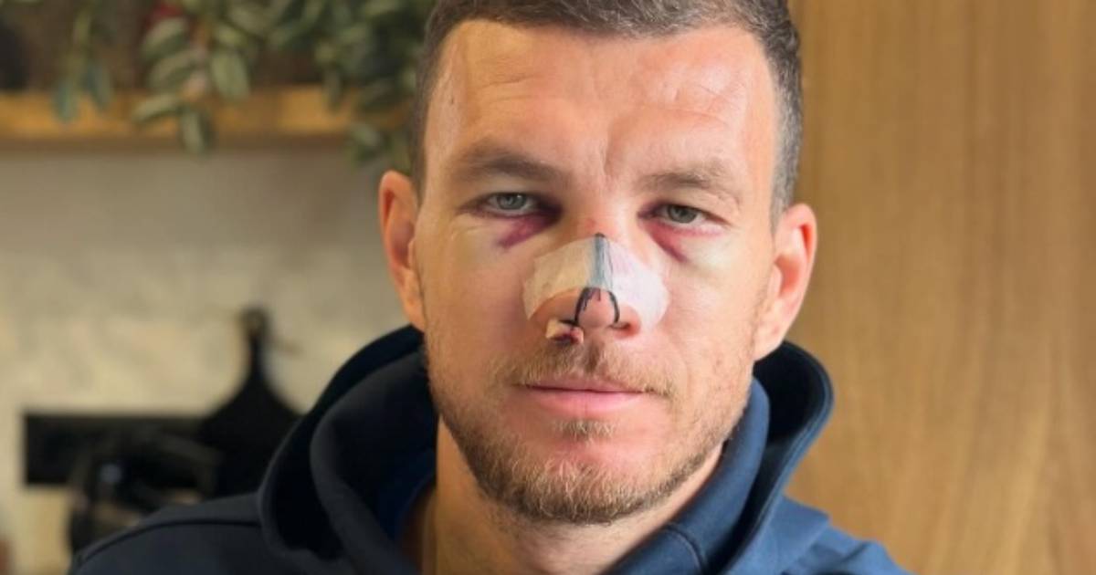 edin dzeko