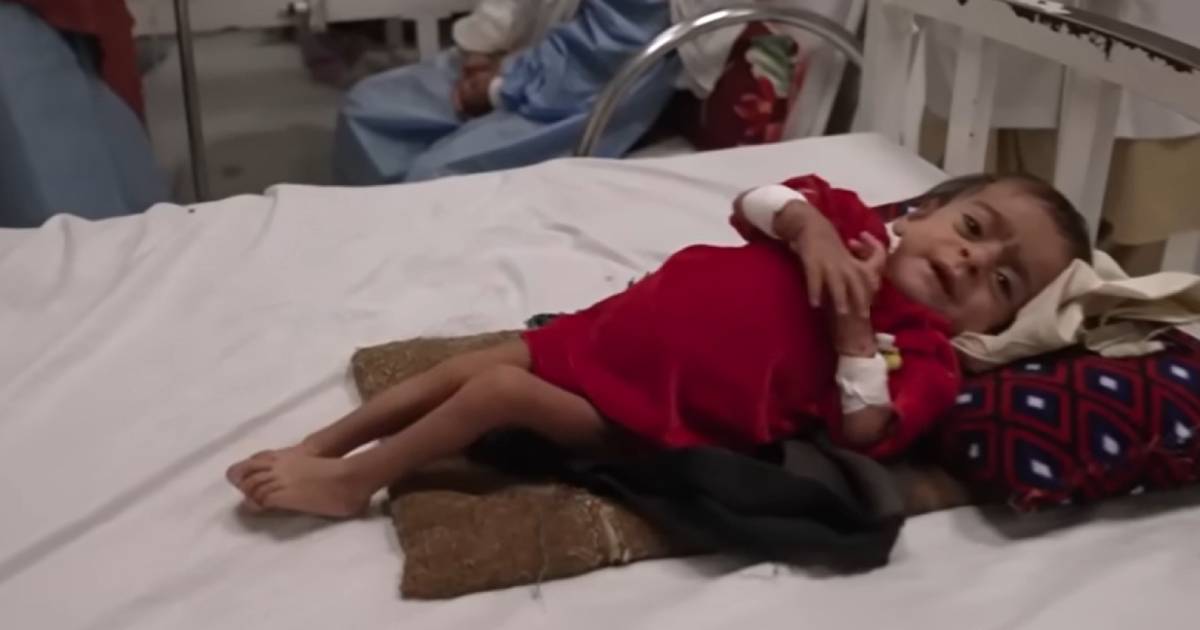 afganistan glad dijete siromaštvo