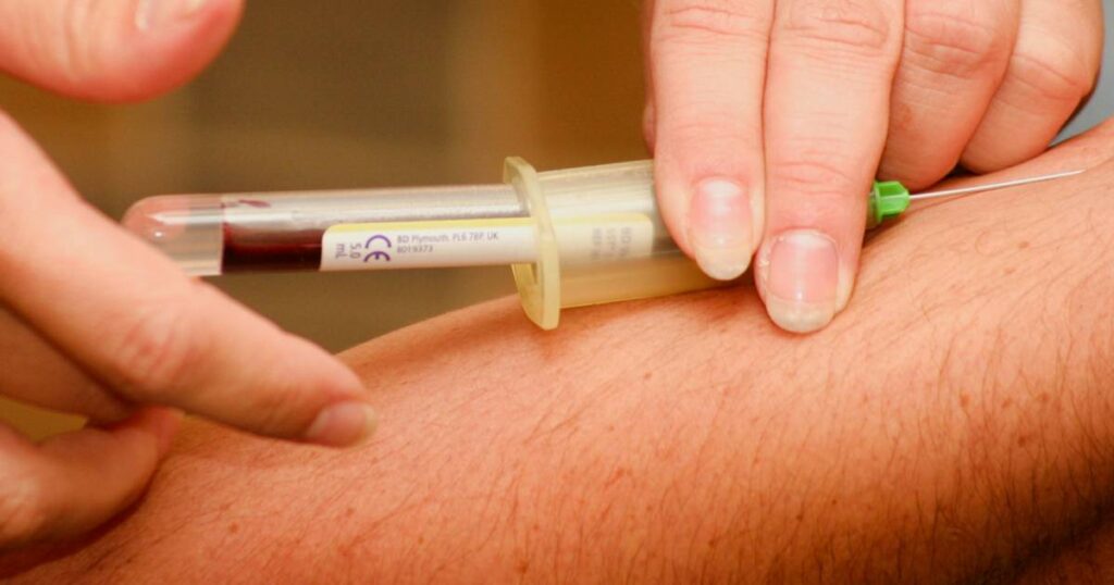 Kako prepoznati visoki holesterol: Tri suptilna znaka koja ne treba ignorisati