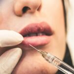 botox uljepsavanje