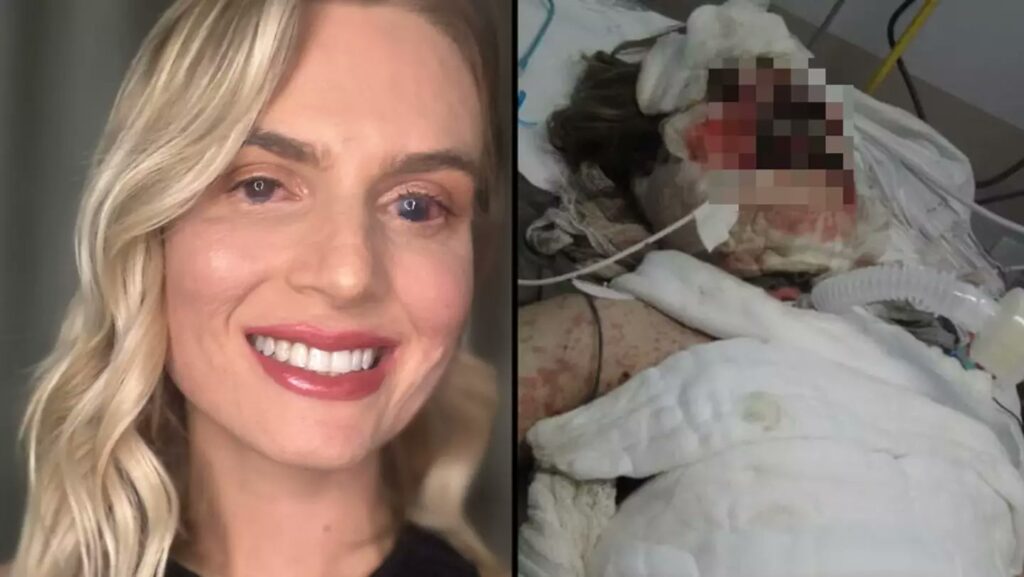 “Kao da sam izgorjela iznutra”: Popila lijek koji mnogi uzimaju protiv bolova i završila u komi
