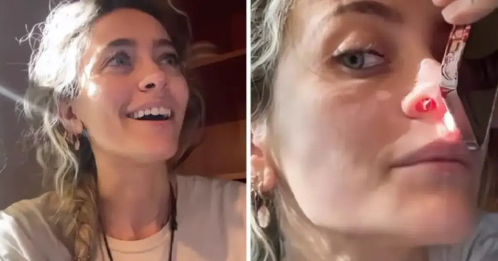 Kćerka Michaela Jacksona pokazala šta droga napravi od nosnica