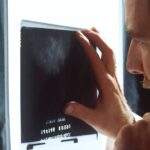 Novi AI test može predvidjeti koji će muškarci imati koristi od lijeka za rak prostate