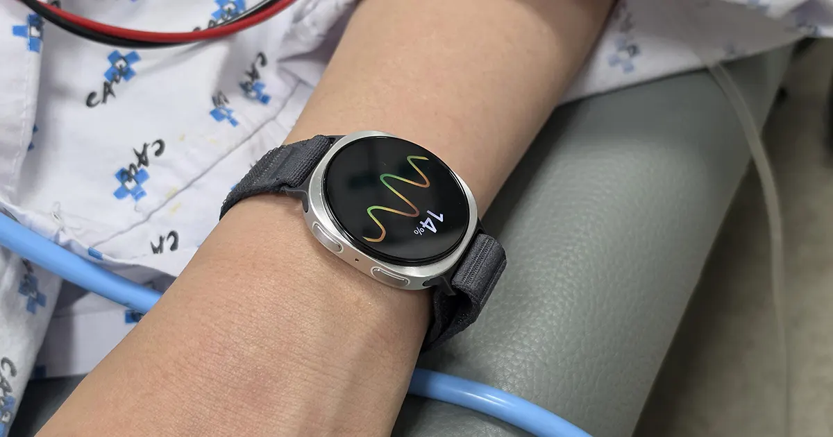 Samsung predstavio rješenje za predviđanje nesvjestice uz pomoć Galaxy Watch uređaja