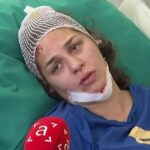 Anja Ljubojević povrijeđena u saobraćajnoj nesreći
