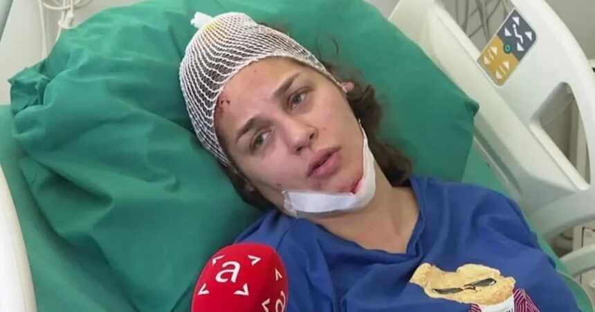 Anja Ljubojević povrijeđena u saobraćajnoj nesreći