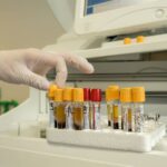 laboratorija krv