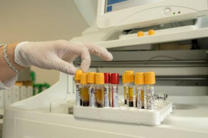 laboratorija krv