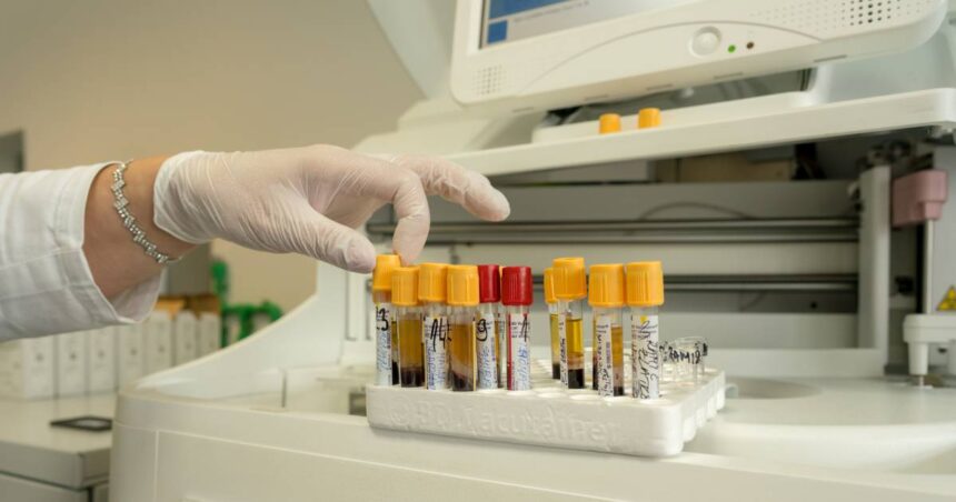 laboratorija krv